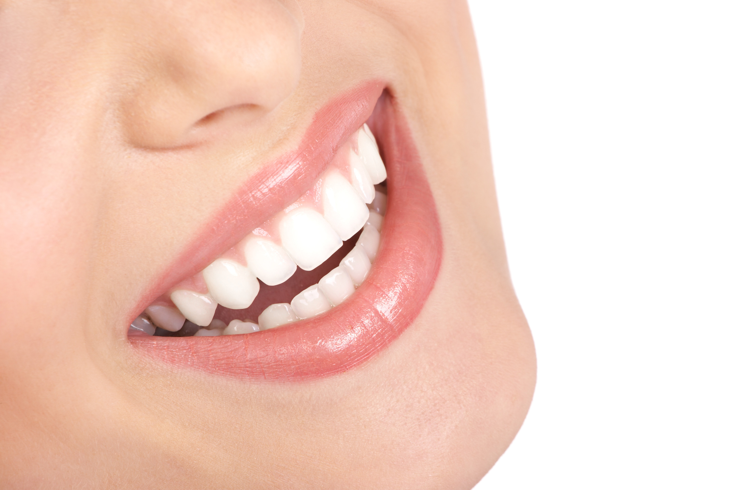 Estética dental: carillas de porcelana 