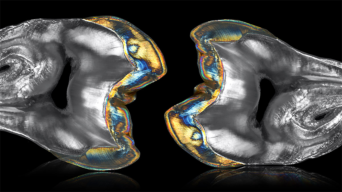 endodoncia en rayos x