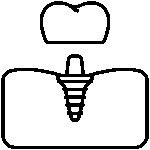 tratamiento de implante dental